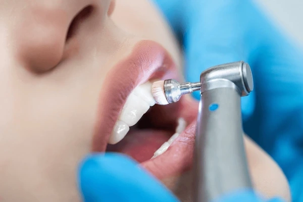 dental cleanings near you