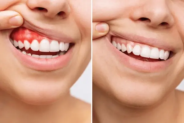 periodontal treatment near you